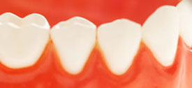 Gum Disease Treatment in Bowral